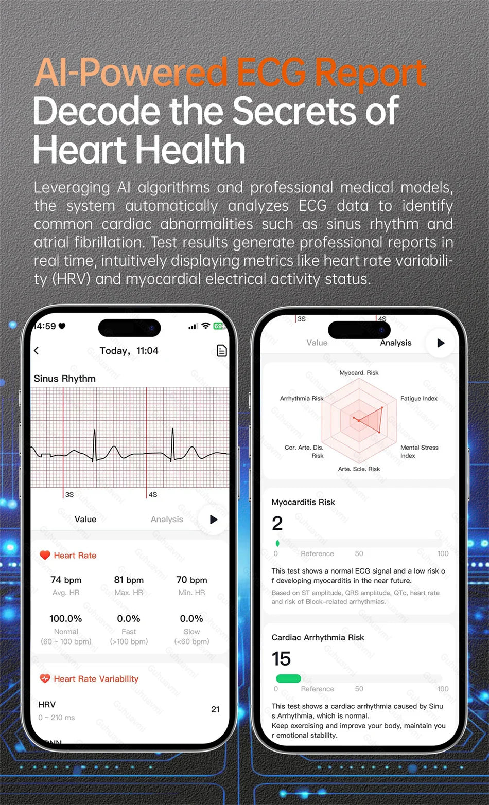 2026 New Smart Watch NFC ECG+PPG Blood oxygen Uric Acid Blood Pressure