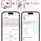 New Men Accurate Health Diagnosis ECG Smart Watch Blood Pressure Smartwatch