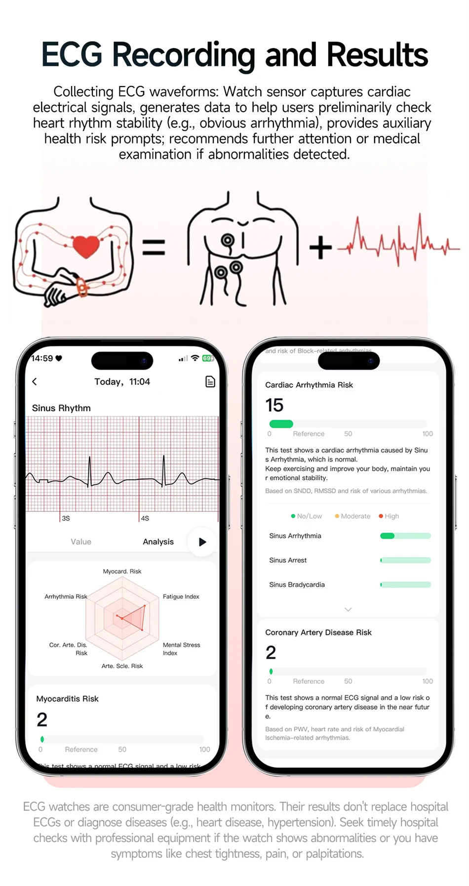 New Men Accurate Health Diagnosis ECG Smart Watch Blood Pressure Smartwatch