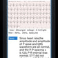 ECG+PPG Smart Wristband Fitness Tracker for Women Men Calorie Blood