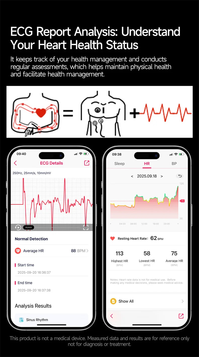 New Accurate ECG Smart Watch Heart Health Analysis Blood oxygen Pressure BT