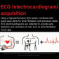 2026 New Accurate Body Health analysis Smart Watch Men ECG Blood lipids Uric